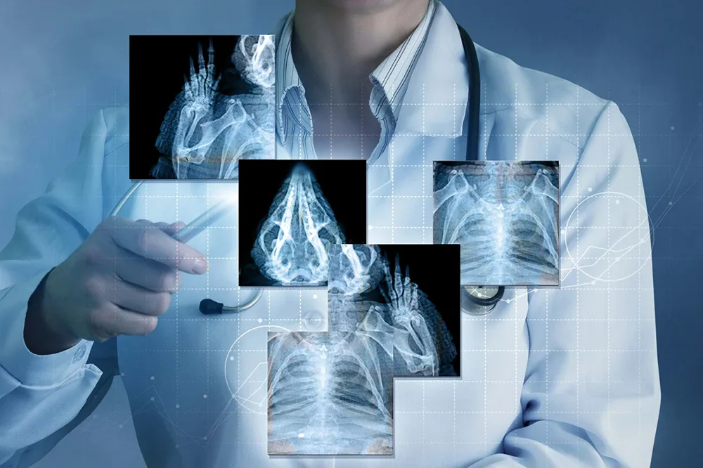 Итоговое тестирование по программе «Рентгенология» (144 ч)